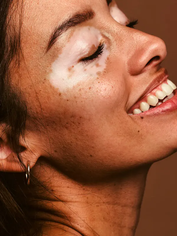 Your skin, our priority