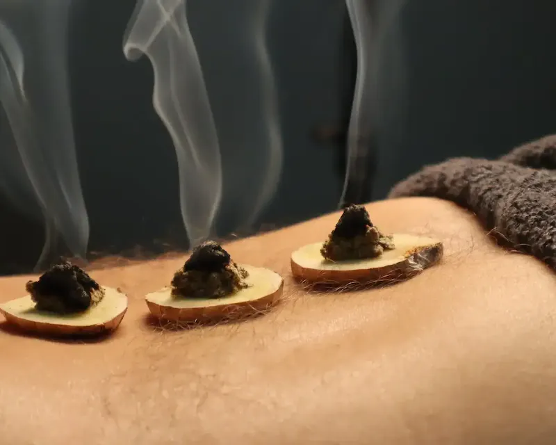 La moxibustion