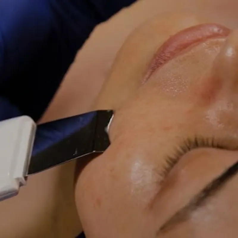 Nettoyage de la peau du visage
